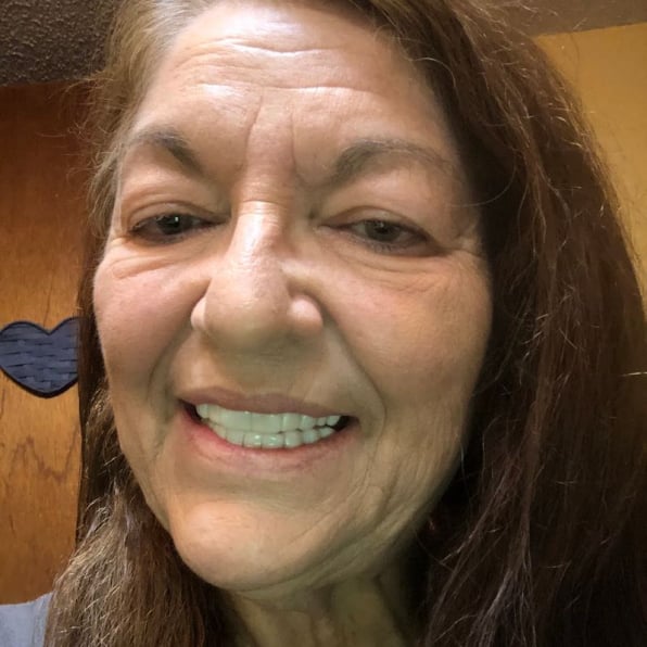 Shiny Smile Veneers Reviews 3